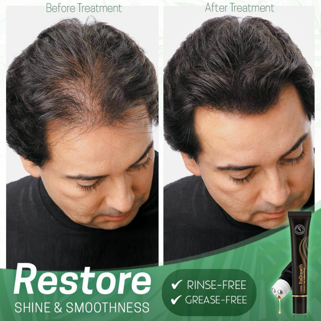 Regrow Bio-Hairserum™ | 1+1 FREE